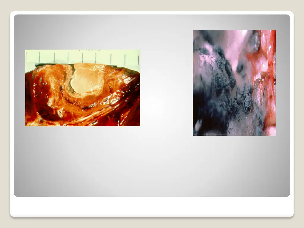 slide5