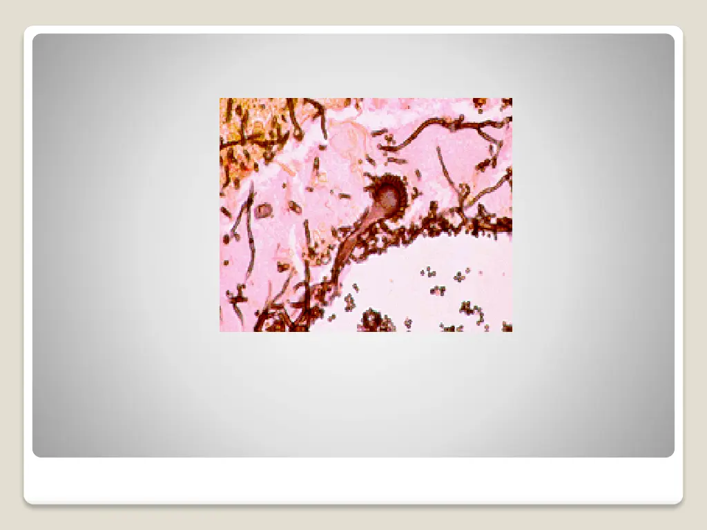 slide9