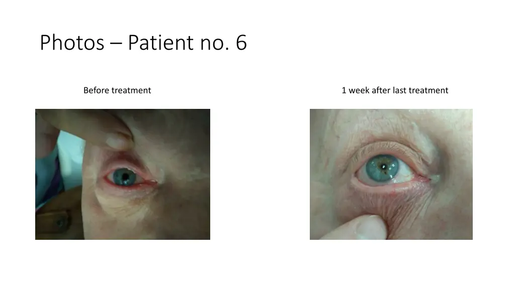 photos patient no 6