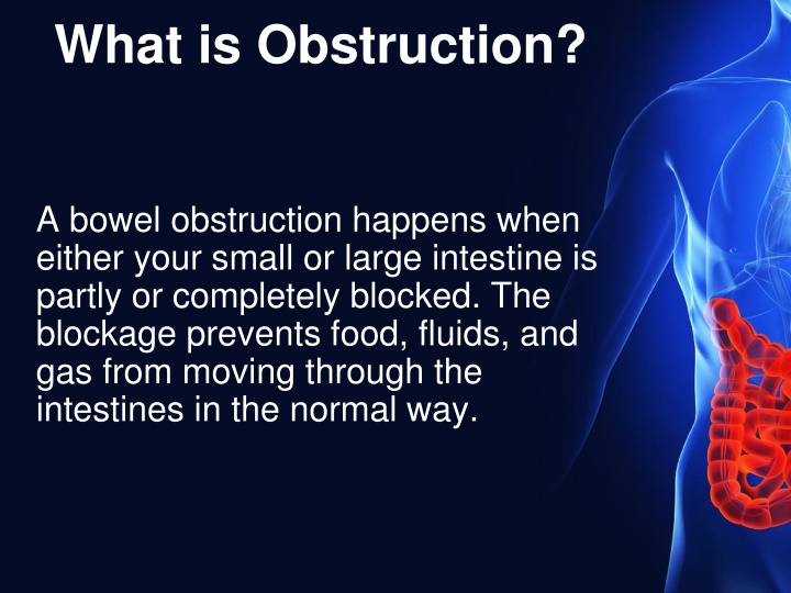what is obstruction