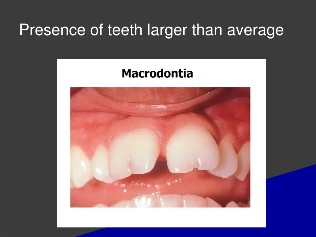 presence of teeth larger than average