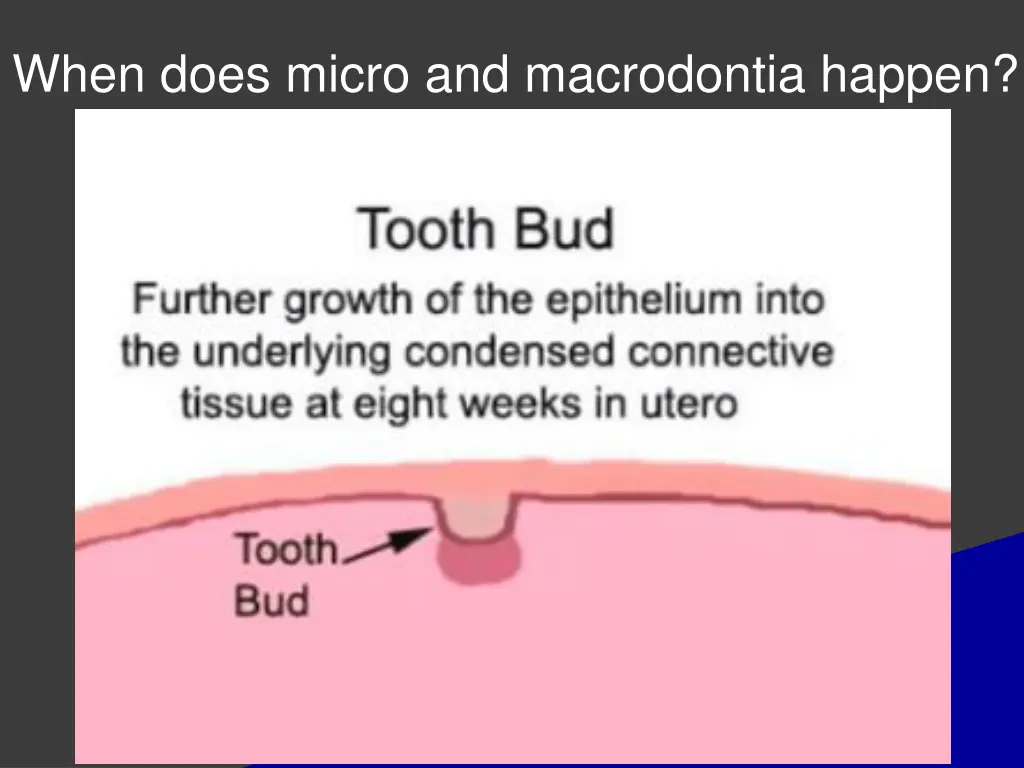 when does micro and macrodontia happen 1
