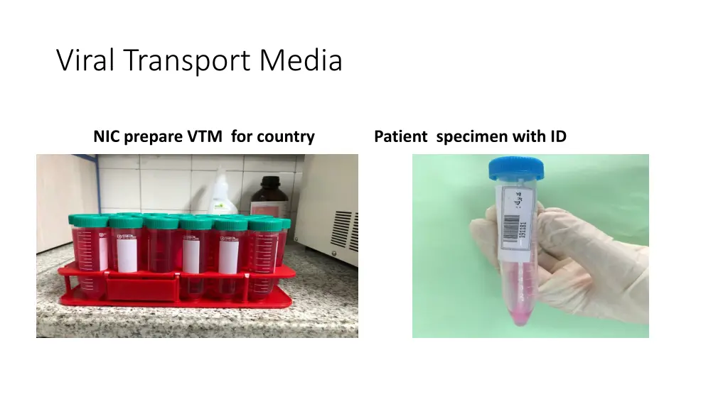 viral transport media