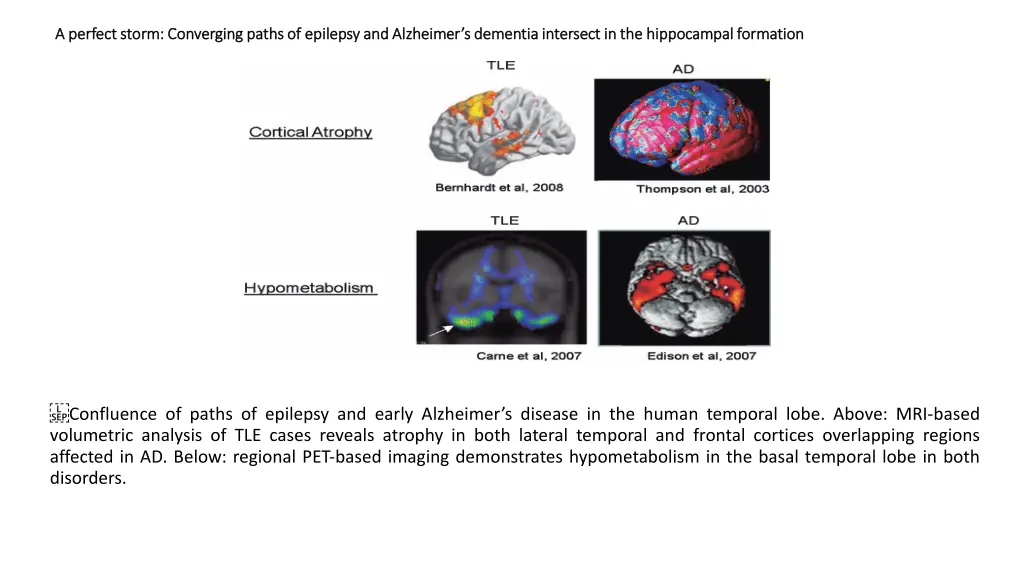 a perfect storm converging paths of epilepsy 2