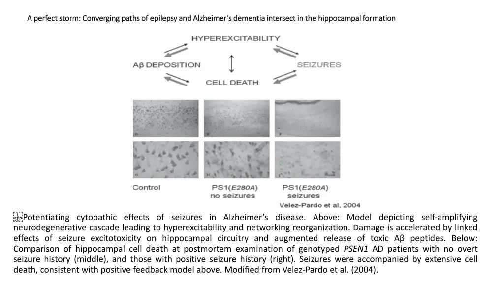 a perfect storm converging paths of epilepsy 3