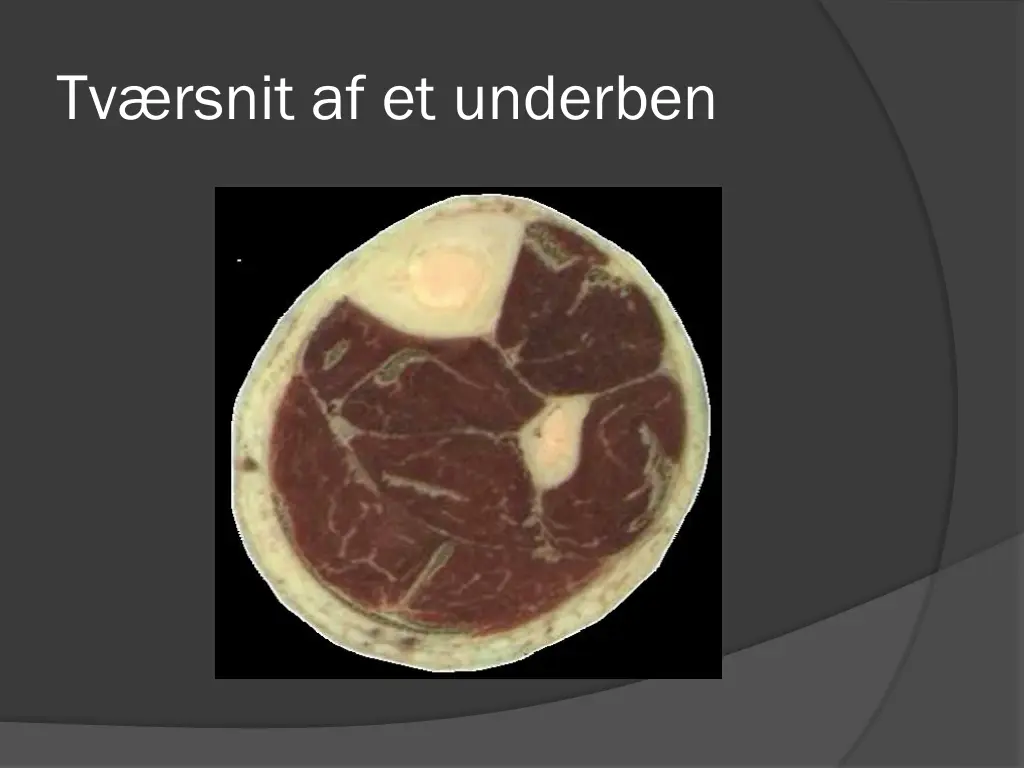 tv rsnit af et underben