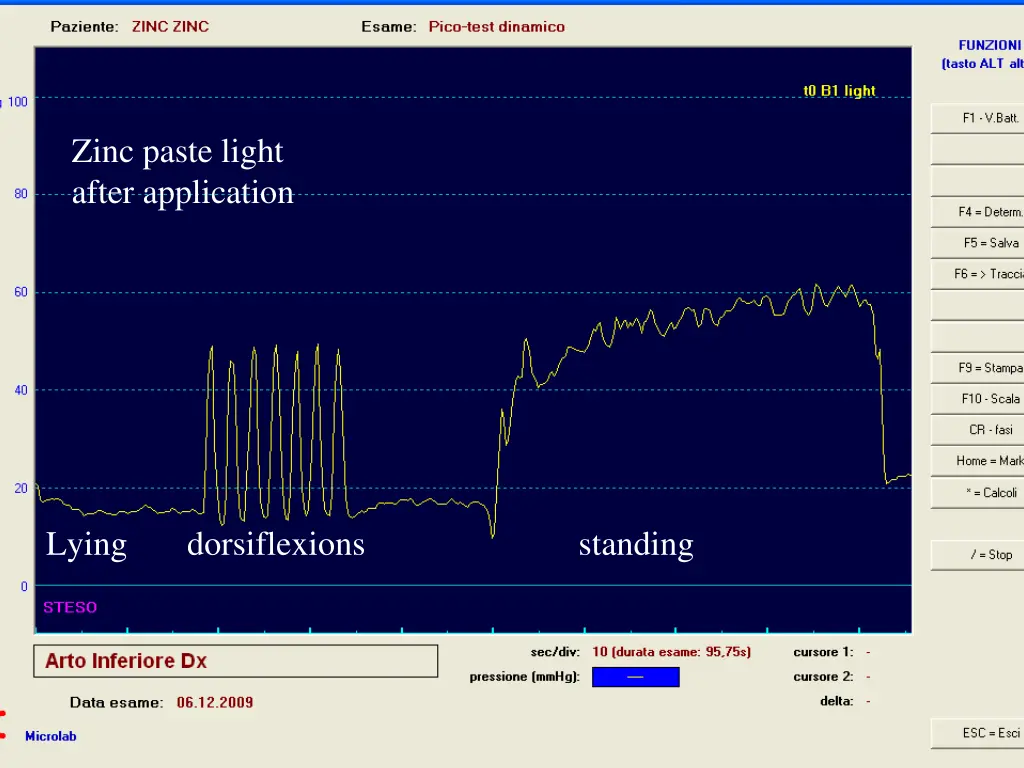 zinc paste light after application