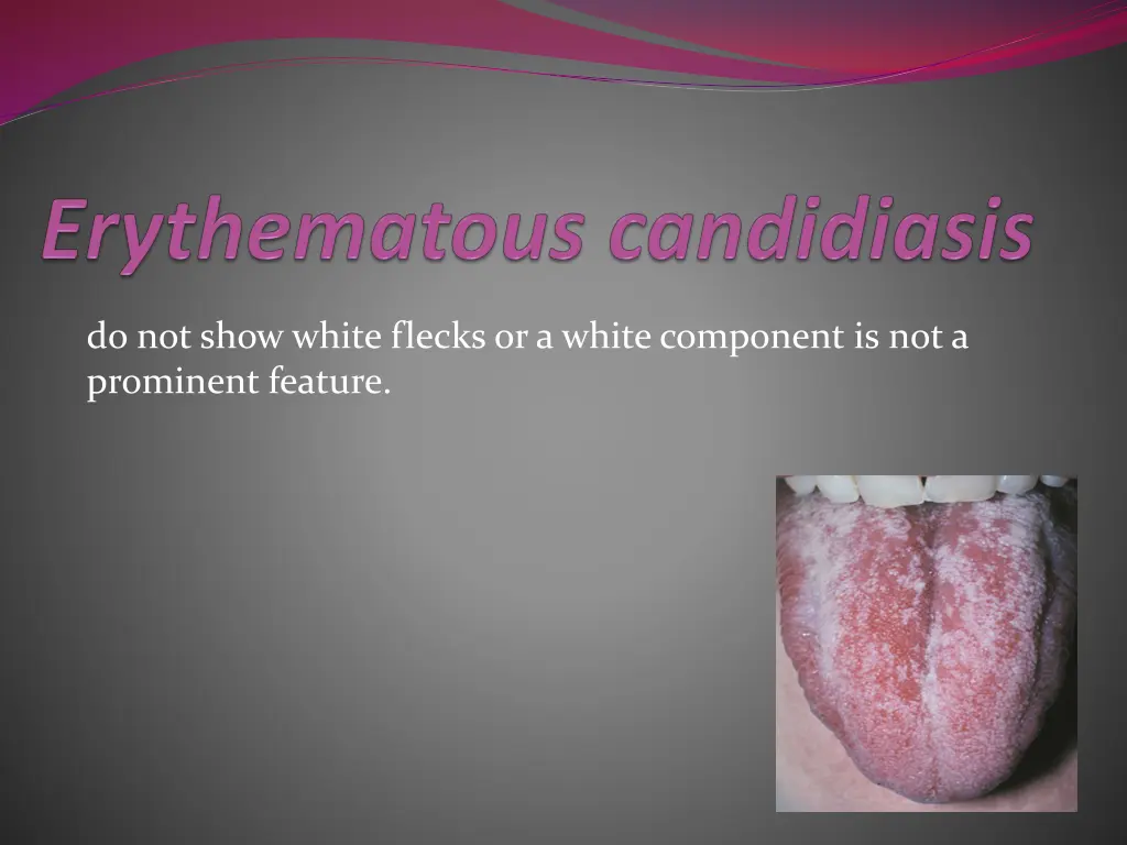 do not show white flecks or a white component