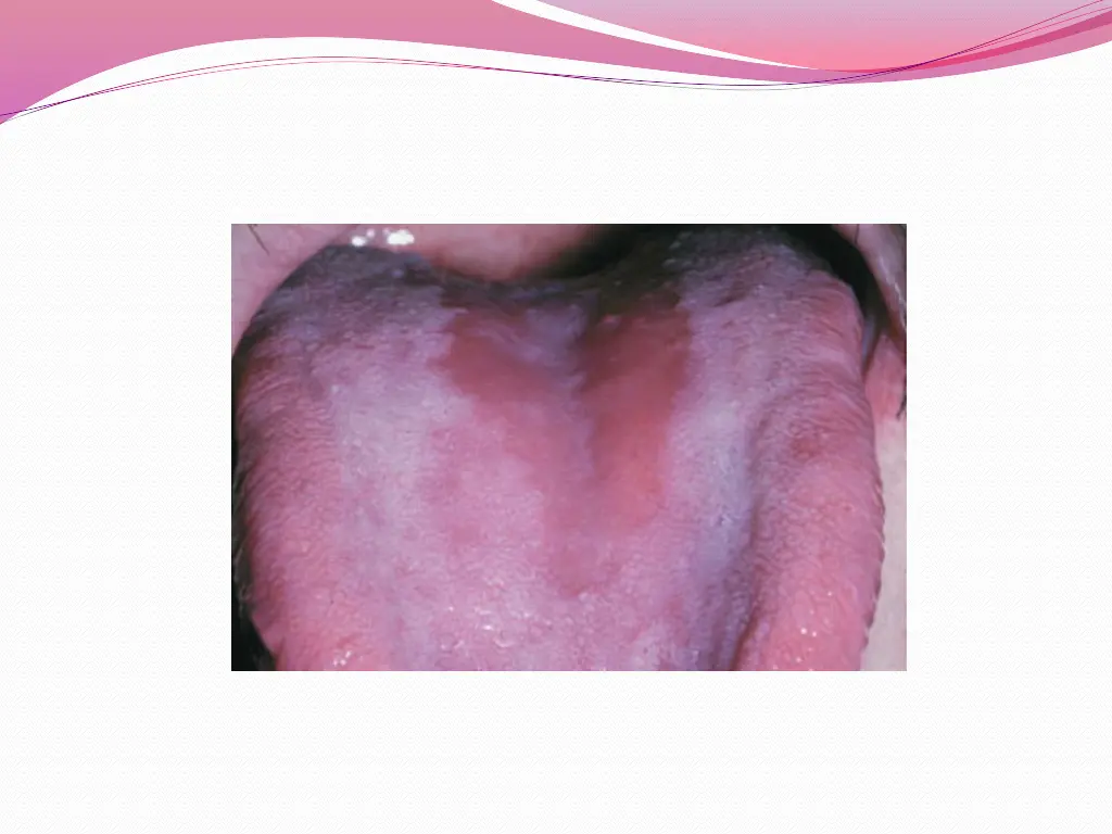 slide12
