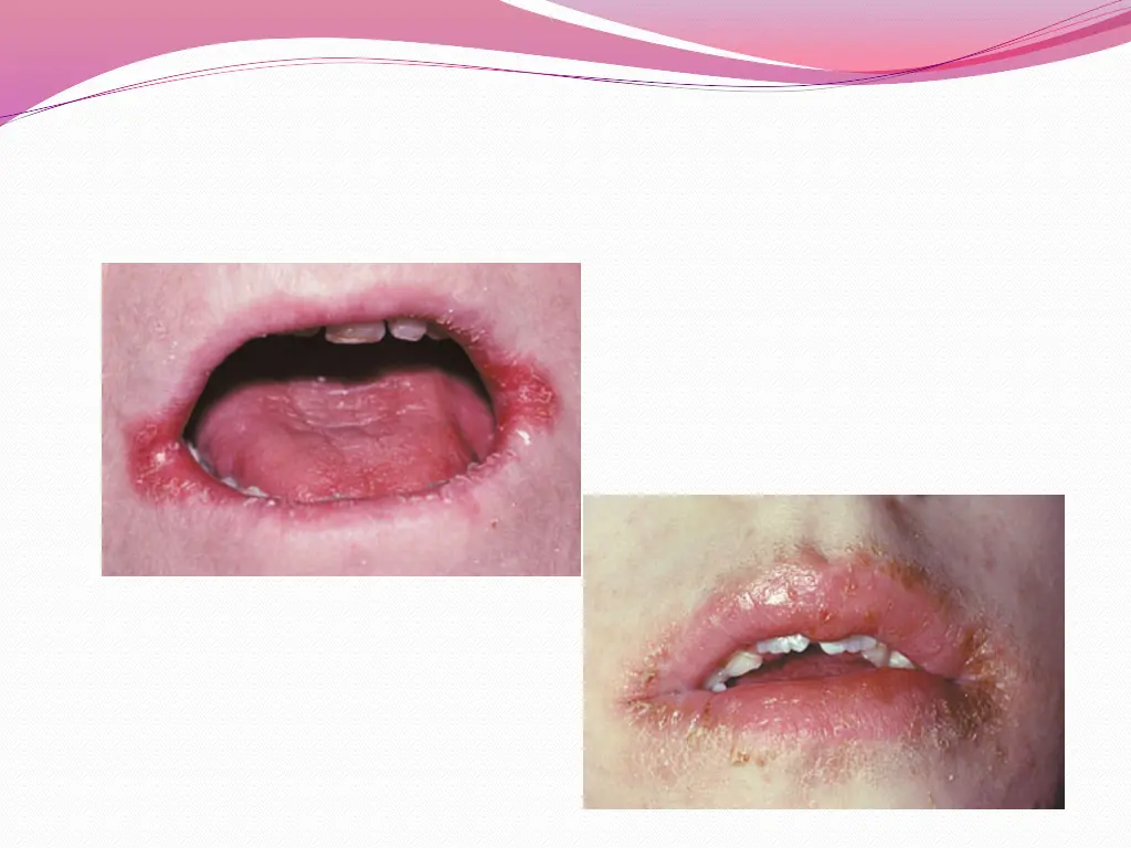 slide16