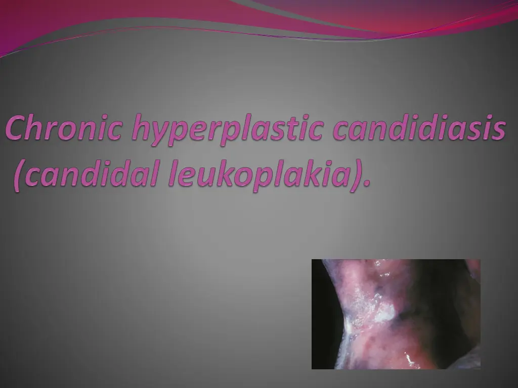 slide19