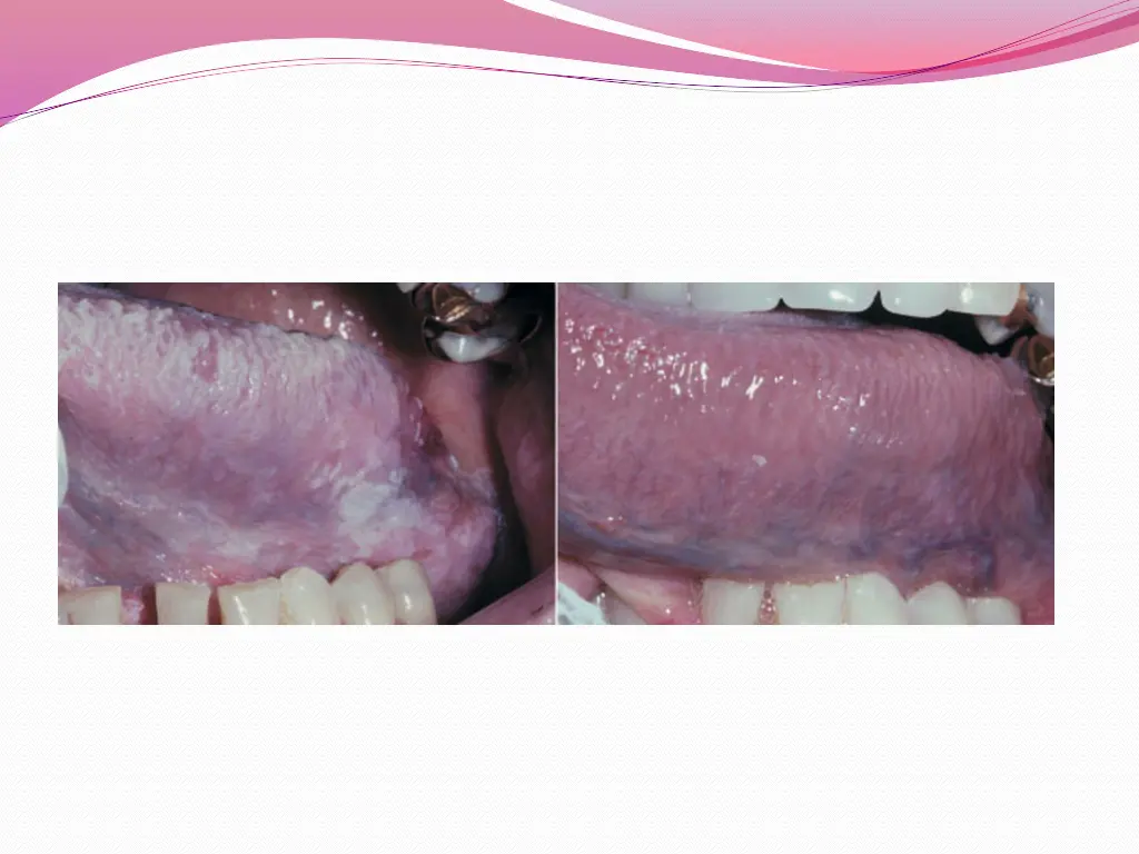 slide21