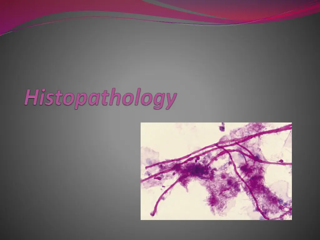 slide25