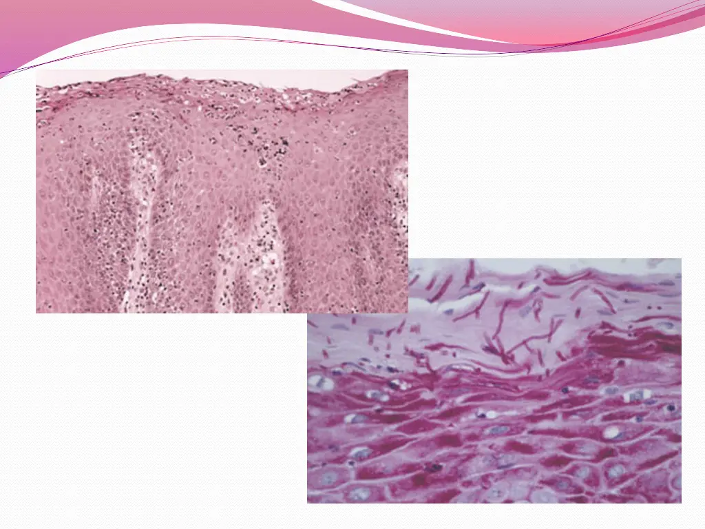 slide27