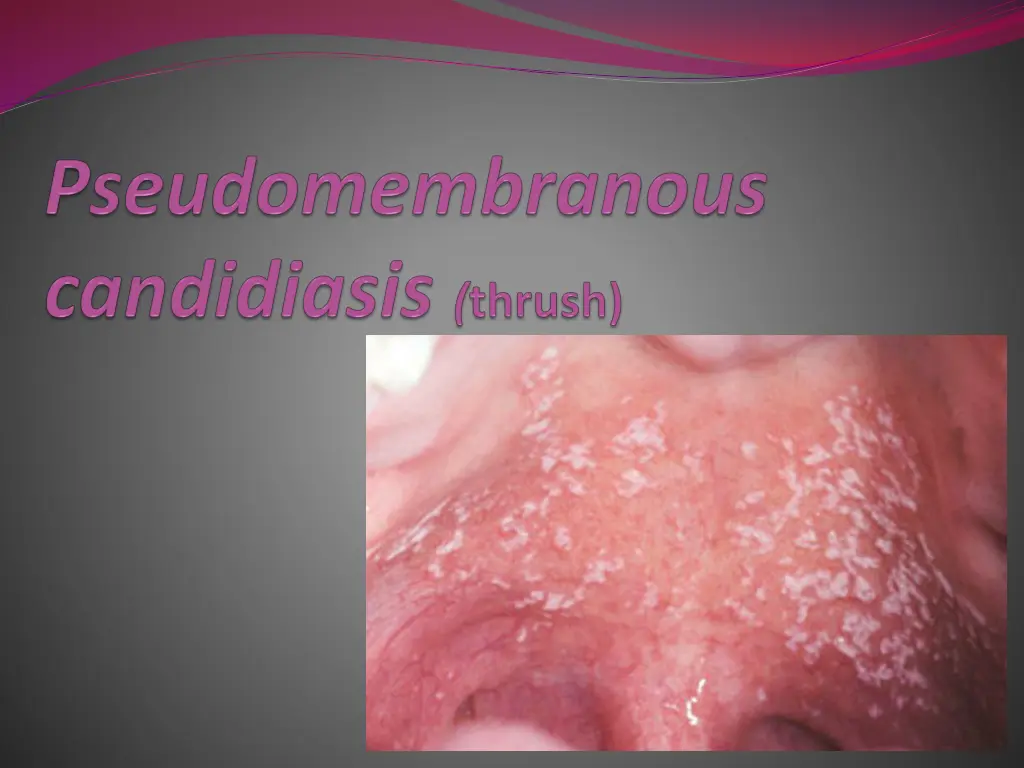 slide6