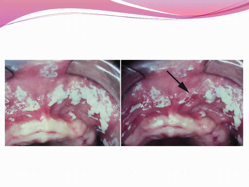 slide9