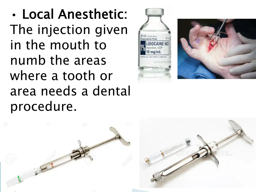 local anesthetic the injection given in the mouth