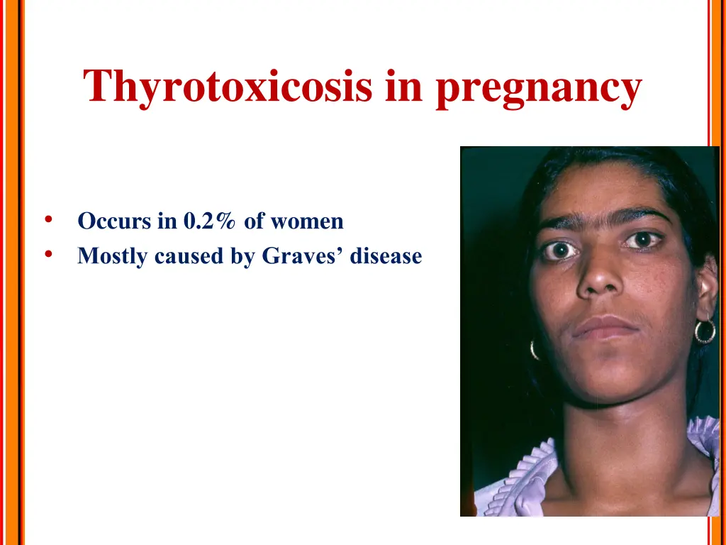 thyrotoxicosis in pregnancy