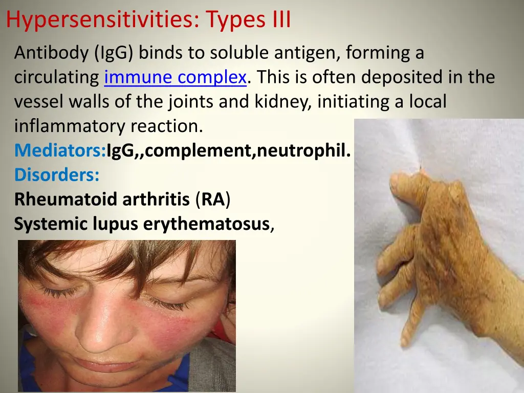 hypersensitivities types iii antibody igg binds