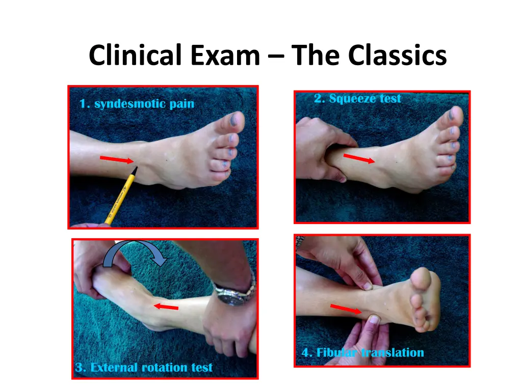 clinical exam the classics