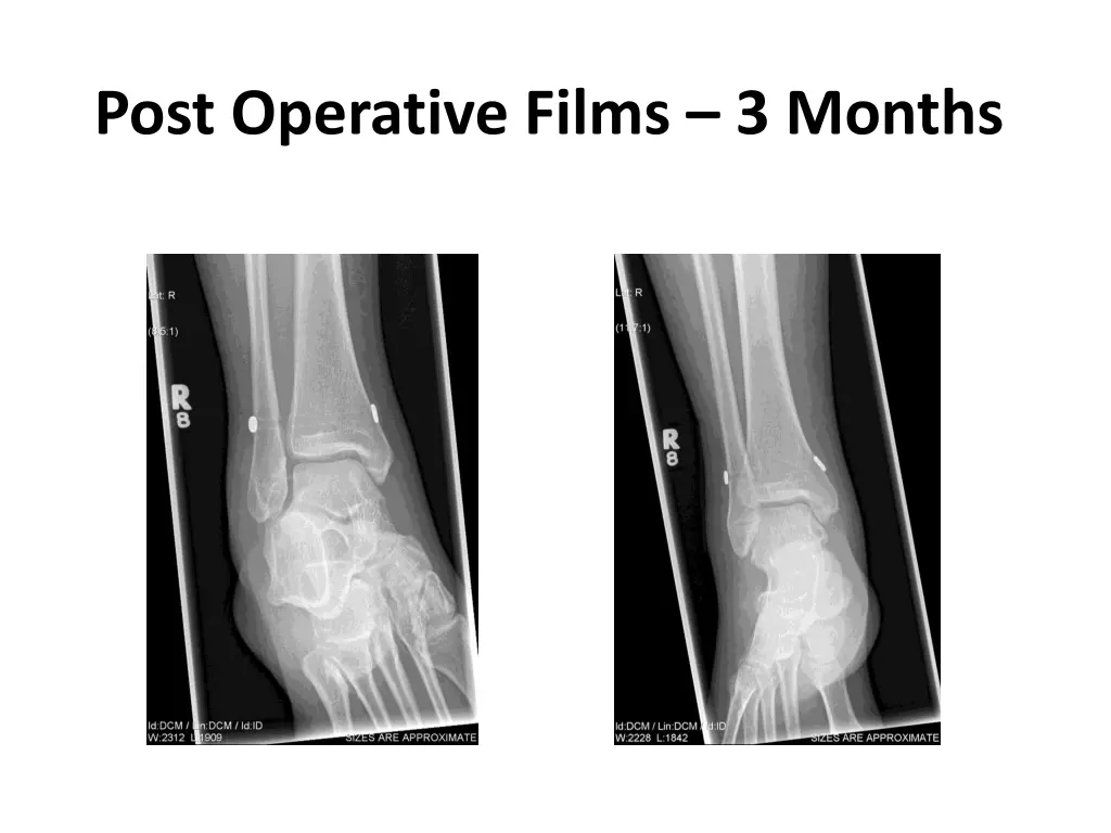 post operative films 3 months