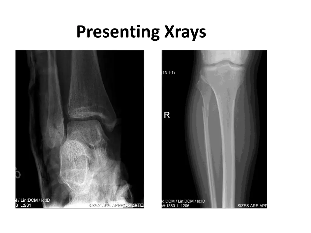 presenting xrays