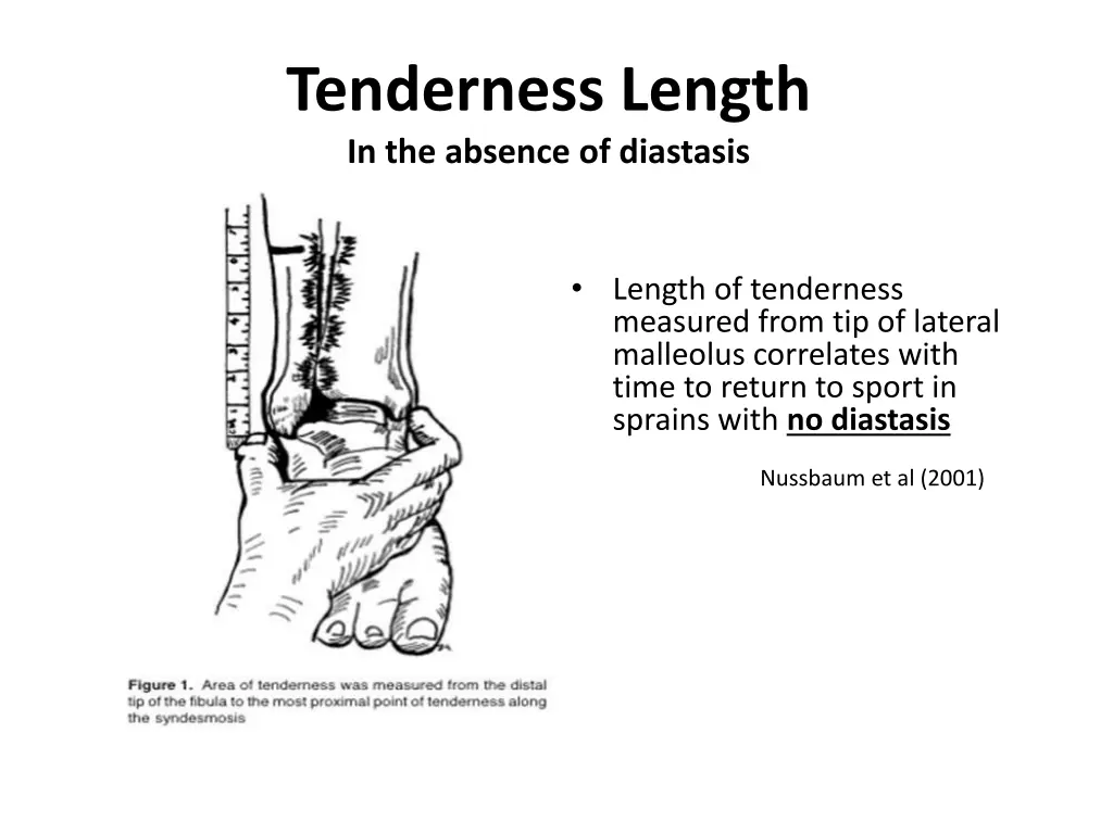 tenderness length in the absence of diastasis