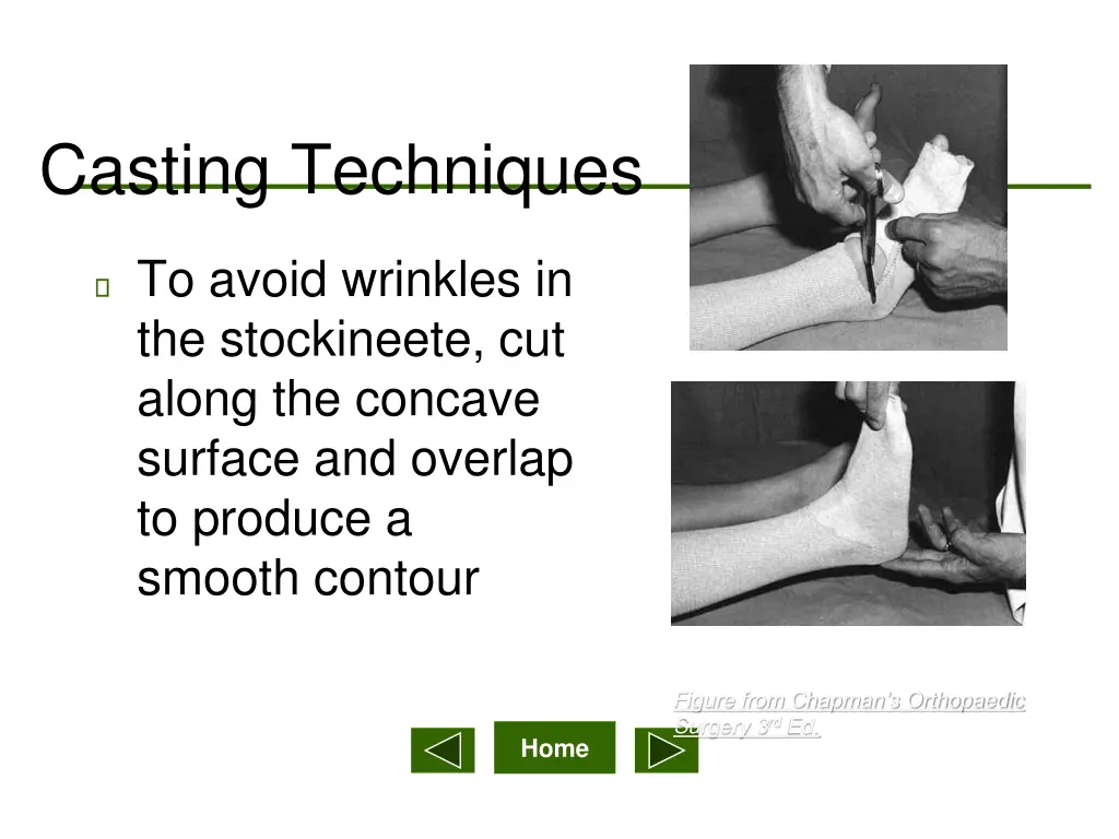 casting techniques 1