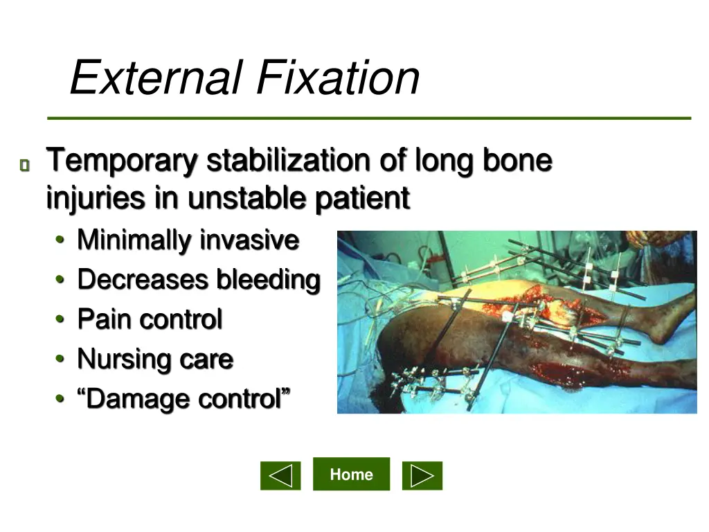 external fixation