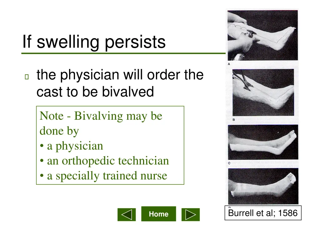 if swelling persists