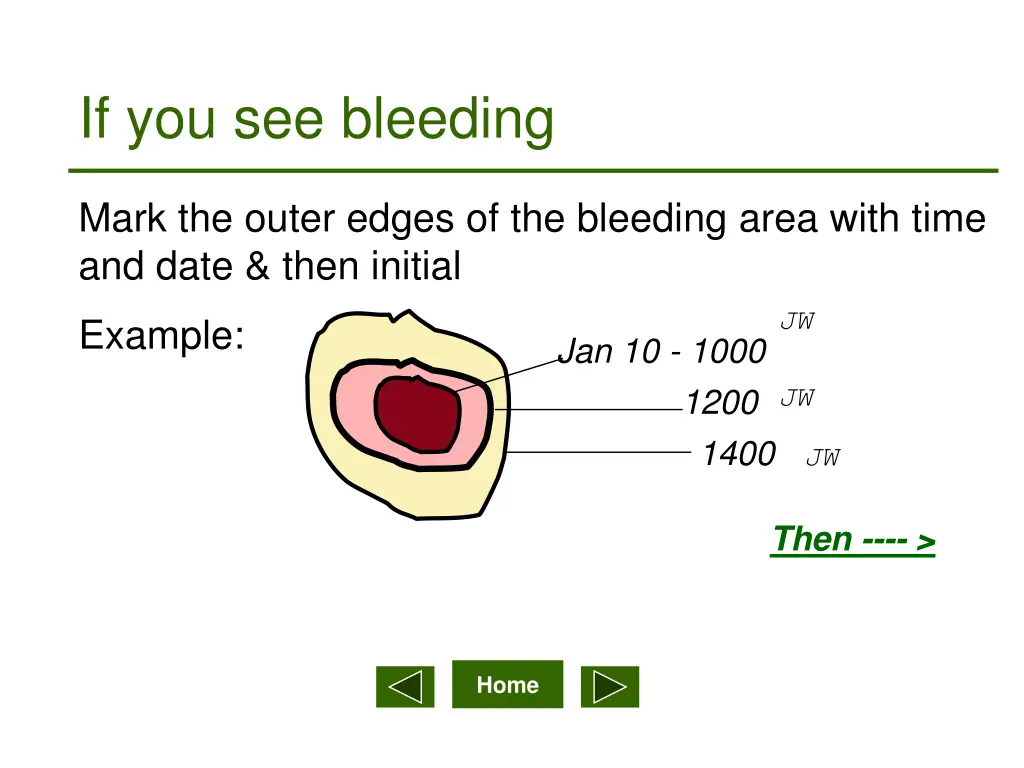 if you see bleeding