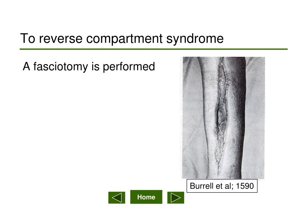 to reverse compartment syndrome