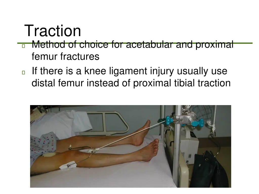 traction method of choice for acetabular