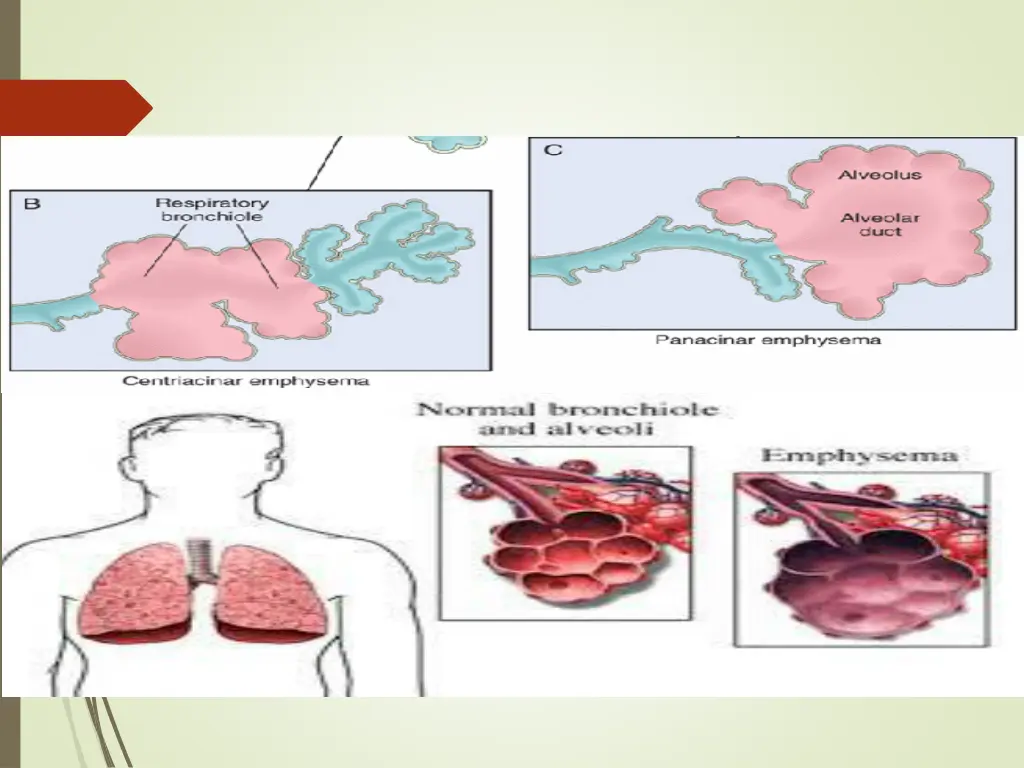 slide12