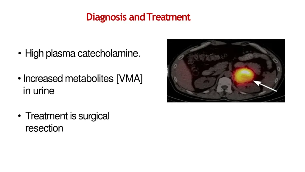 diagnosis andtreatment