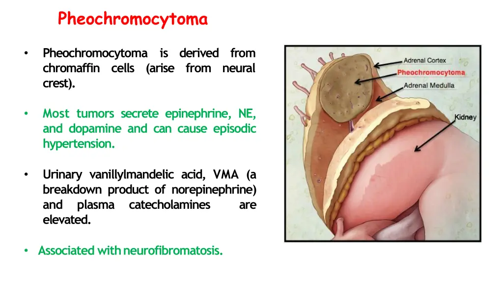 pheochromocytoma 1