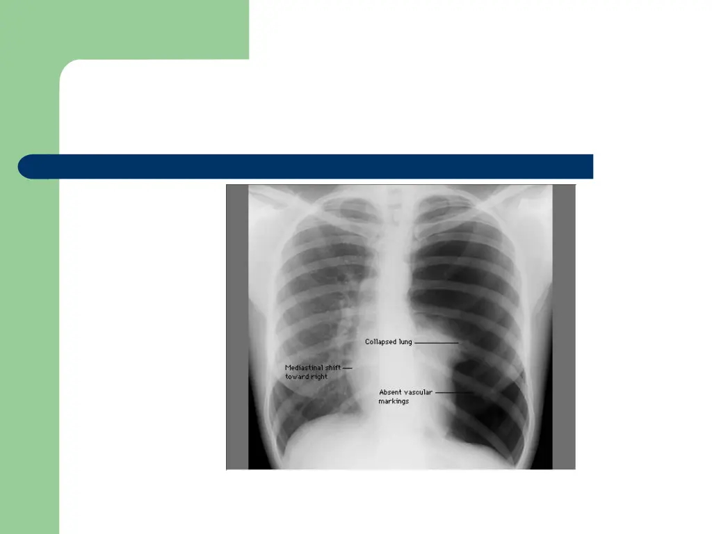 slide12
