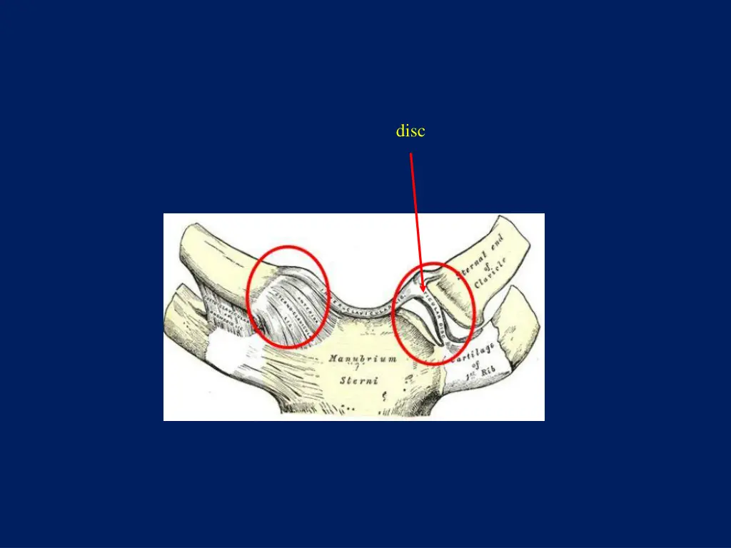 slide11