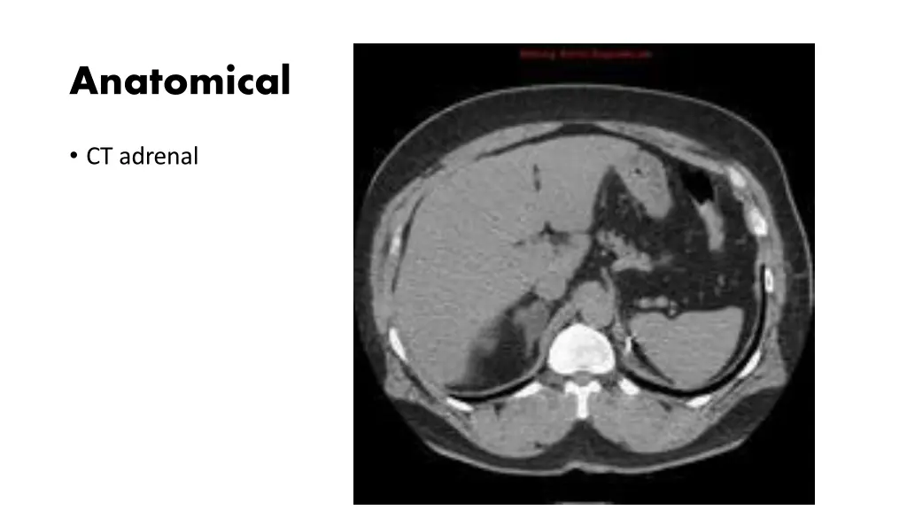 anatomical