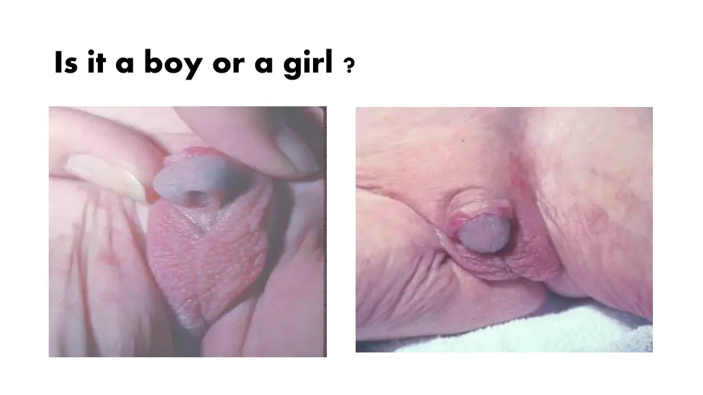 is it a boy or a girl