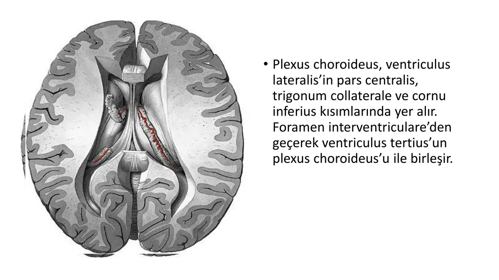 plexus choroideus ventriculus lateralis in pars