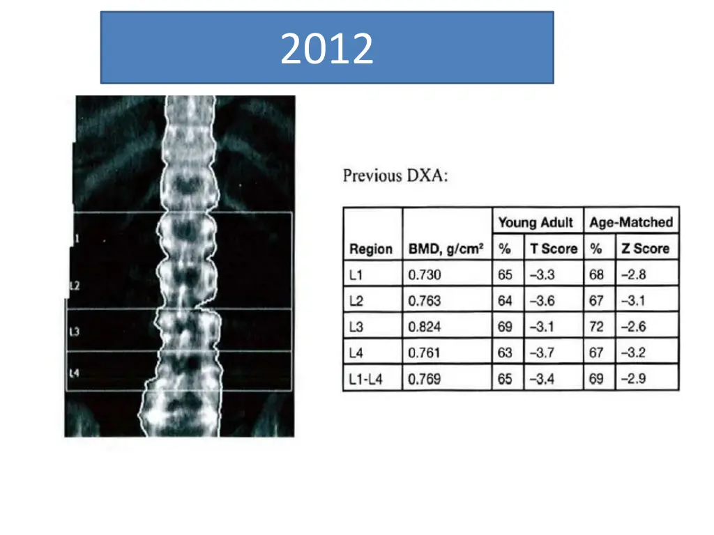 slide4