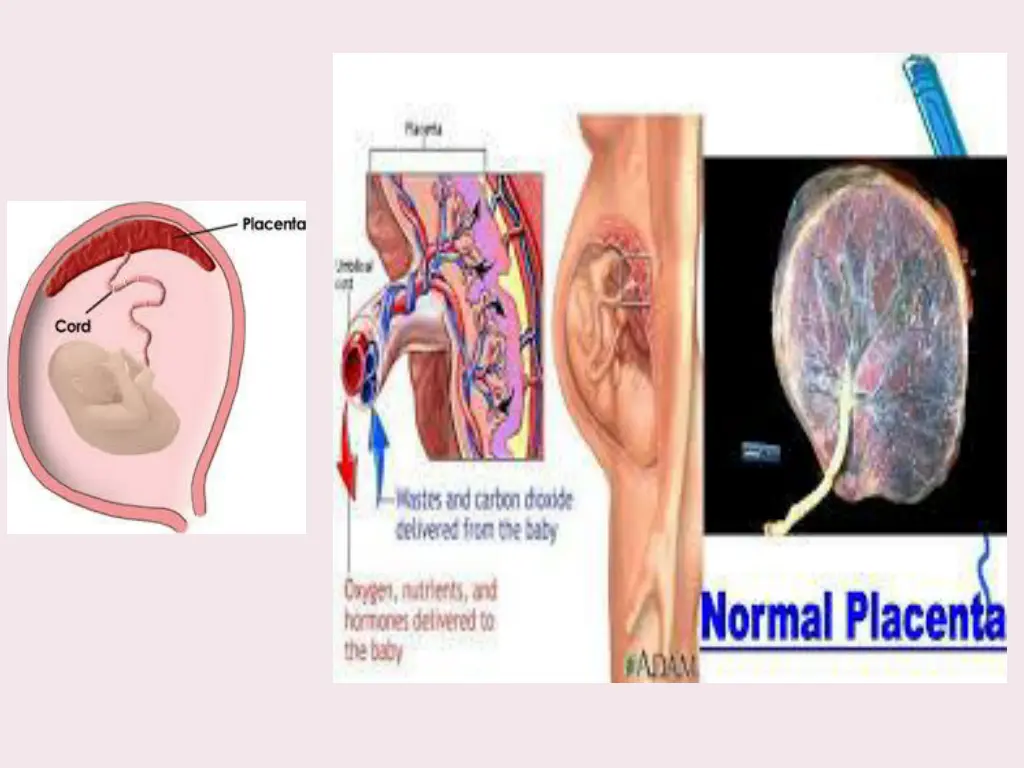 slide3