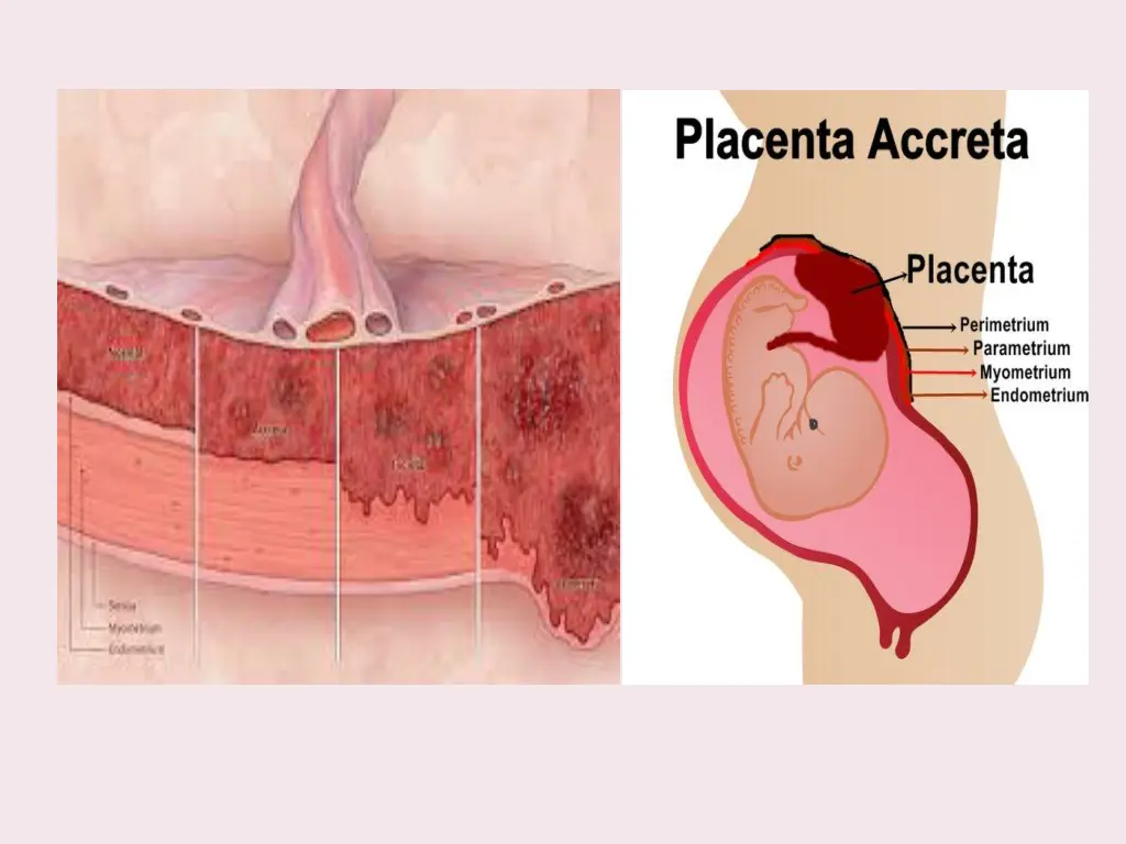 slide9