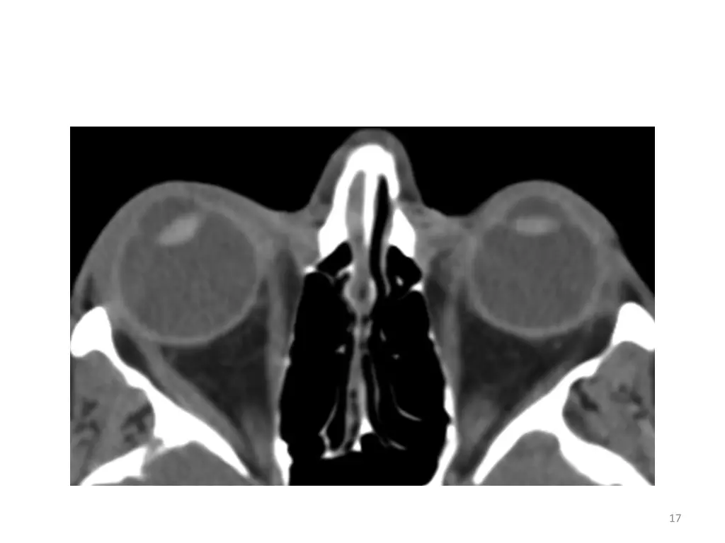 slide17