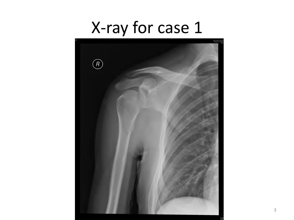 x ray for case 1