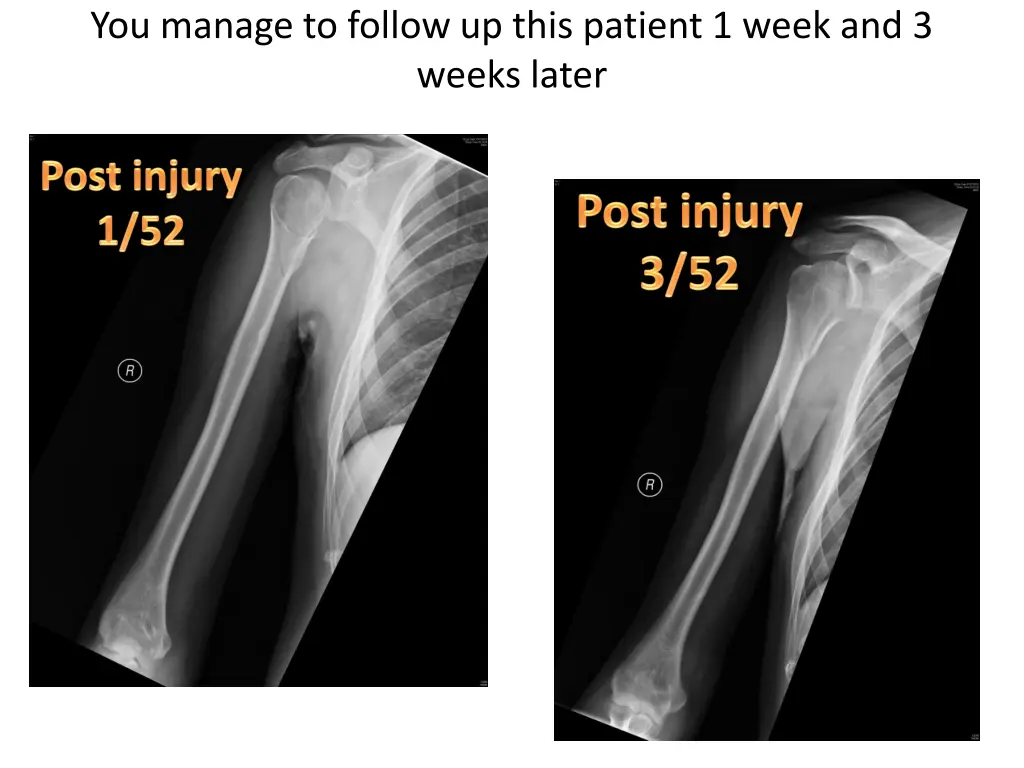 you manage to follow up this patient 1 week