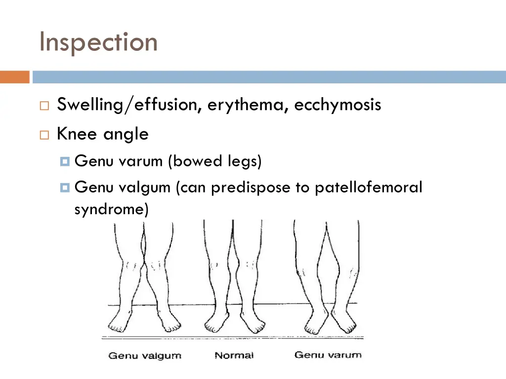 inspection