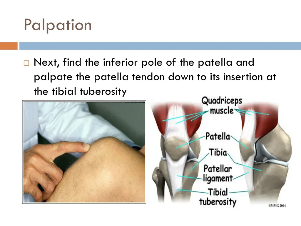 palpation 2
