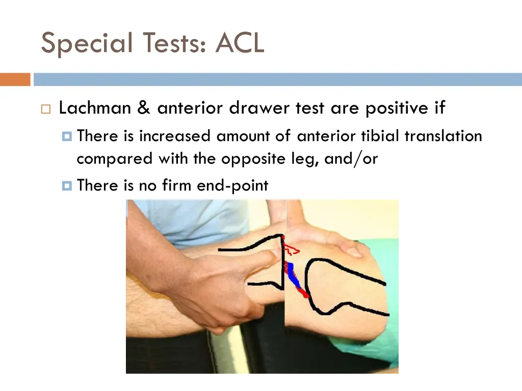 special tests acl 1